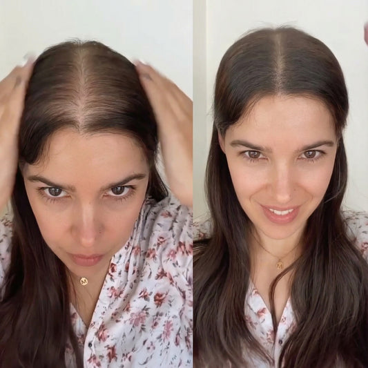 HairFix - Hair Concealer